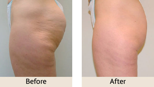Full-Body Slimming Massager